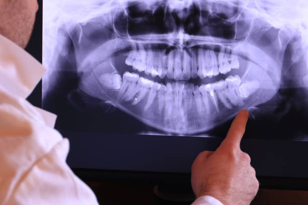 Best Emergency Dental Services for Seniors in Rutland, VT