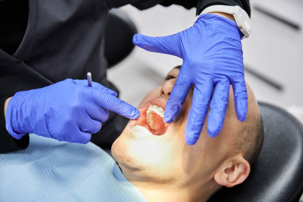 Best Emergency Root Canal Treatment in Rutland, VT
