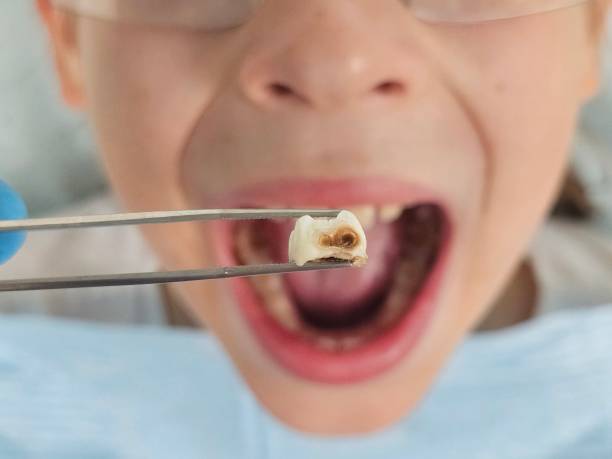 Trusted VT Emergency Dentist Experts