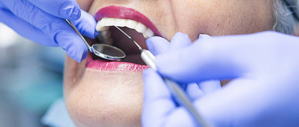 Best Emergency Root Canal Treatment in Rutland, VT